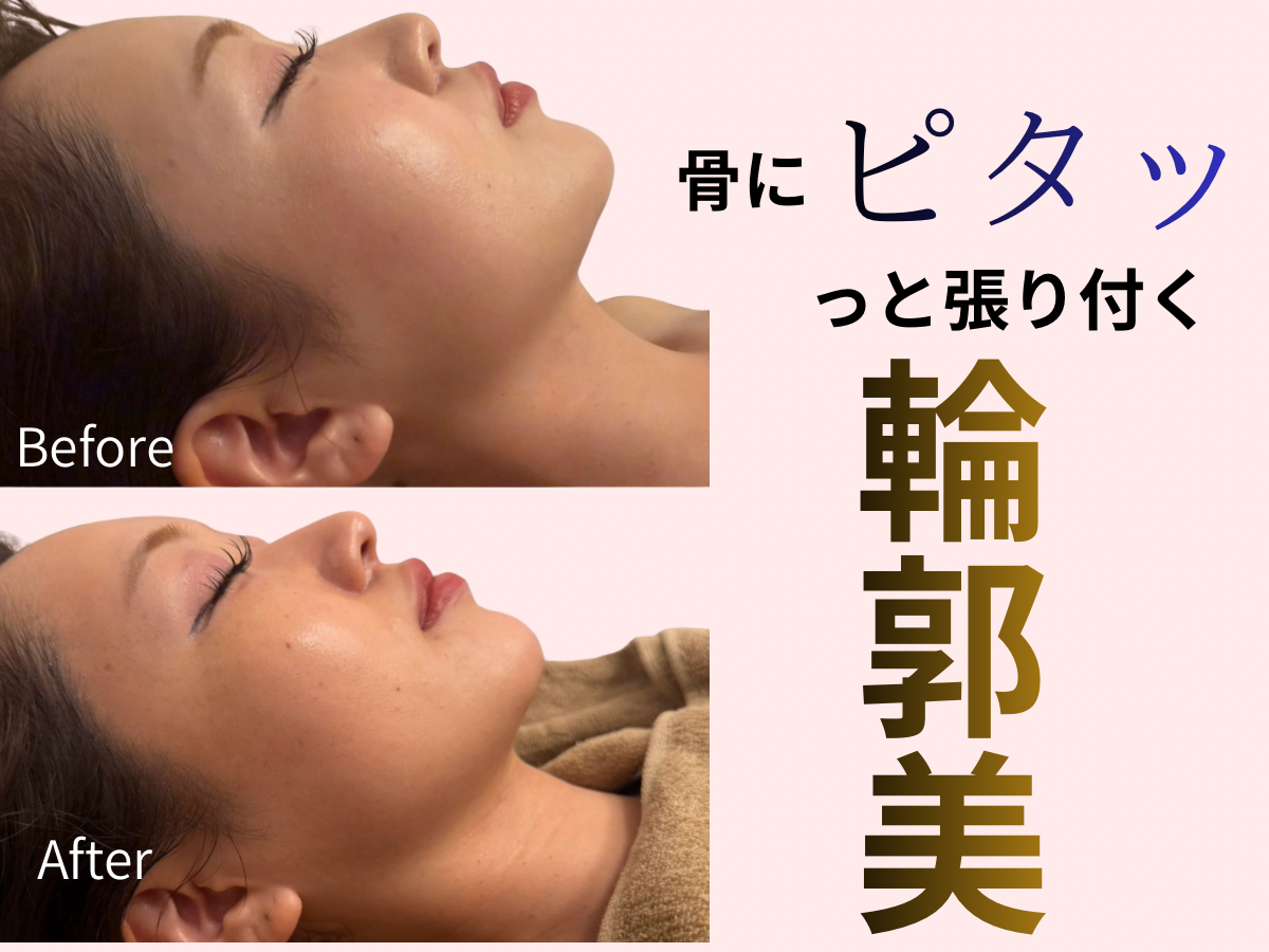 美容医療は怖いけれど…自然に若返りたい方へ【フェイスライン引き締め】