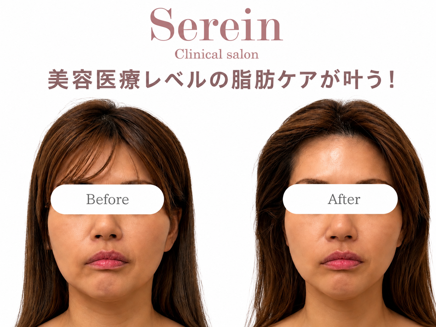 「体重は変わらないのに、顔が大きくなった気がする…」その原因とは？